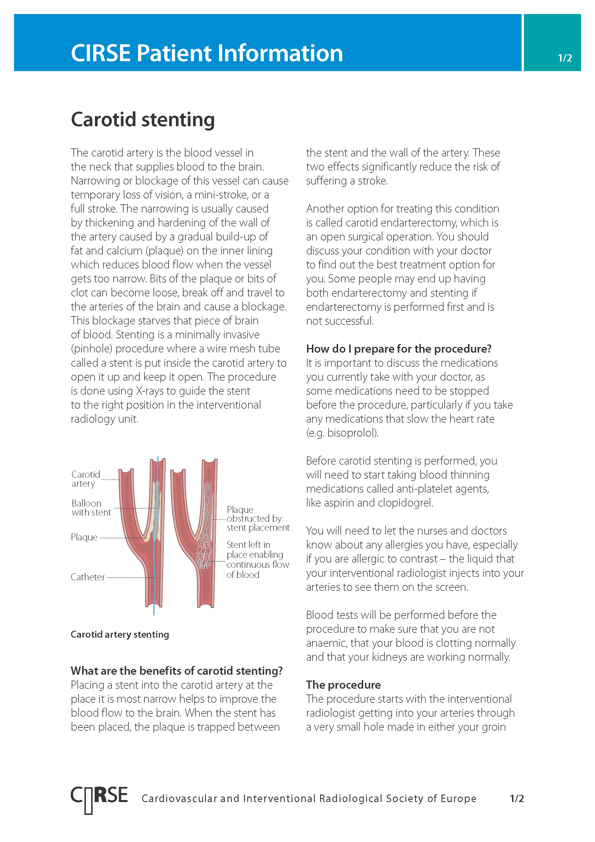 Carotid stenting